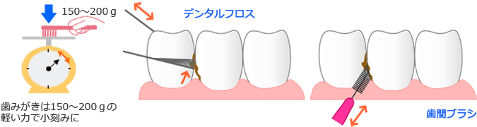 ＴＢＩ（歯磨き指導）