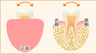 歯の動揺度検査