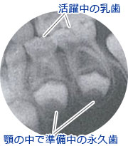 子どもの口腔環境