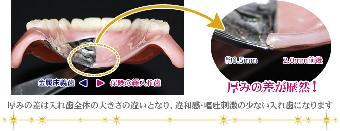 保険の入れ歯と金属床の大きさの比較