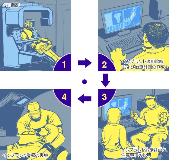 ＣＴ撮影からインプラント治療まで